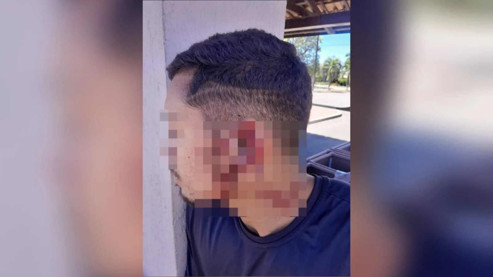 Discussão sobre política termina com entregador ferido após mordida na orelha